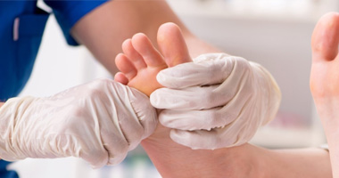 Neuropathy